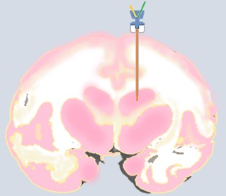 Schematic diagram of brain microdialysis in NHPs