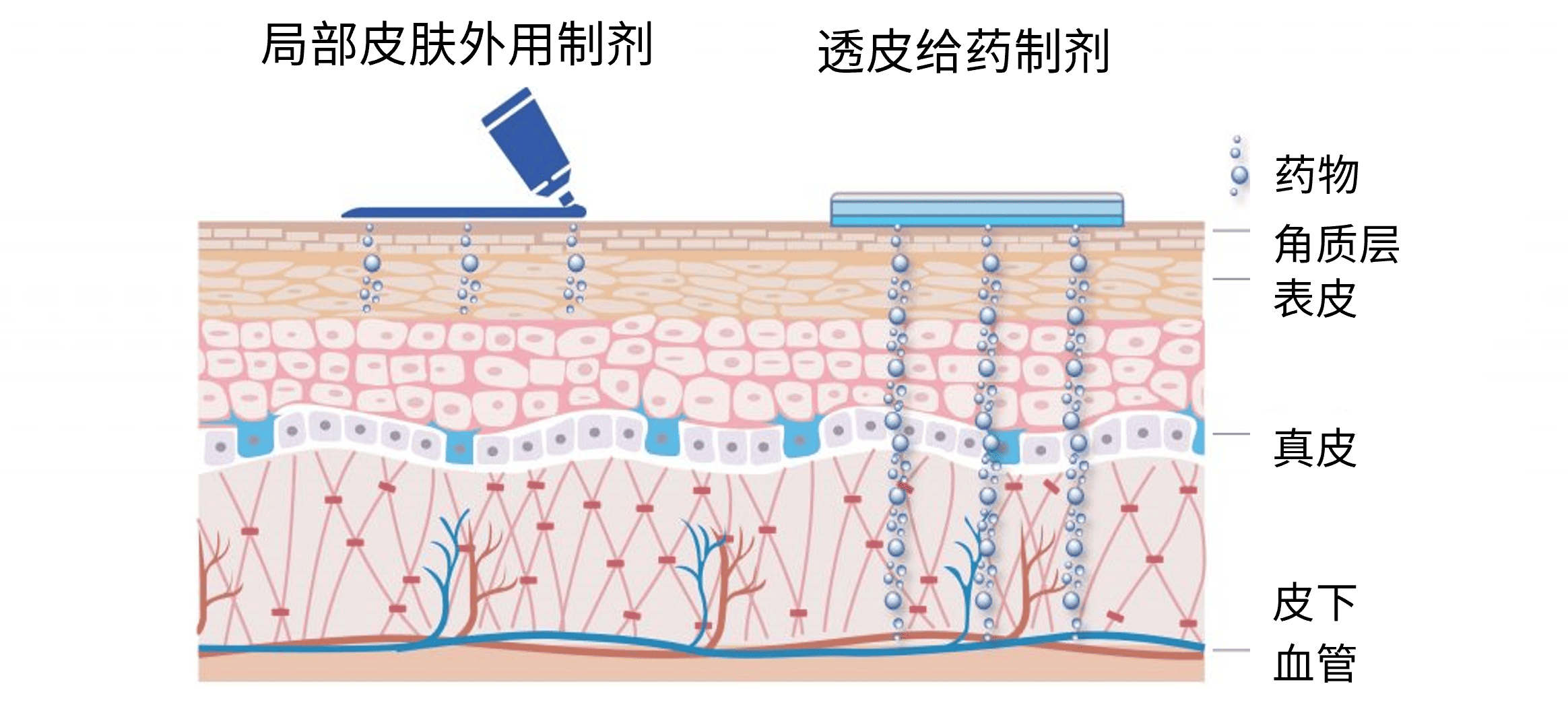 皮肤外用制剂和透皮制剂的药物渗透示意图