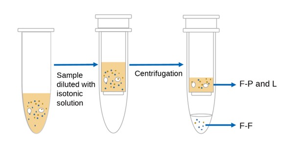 General Process of Ultrafiltration